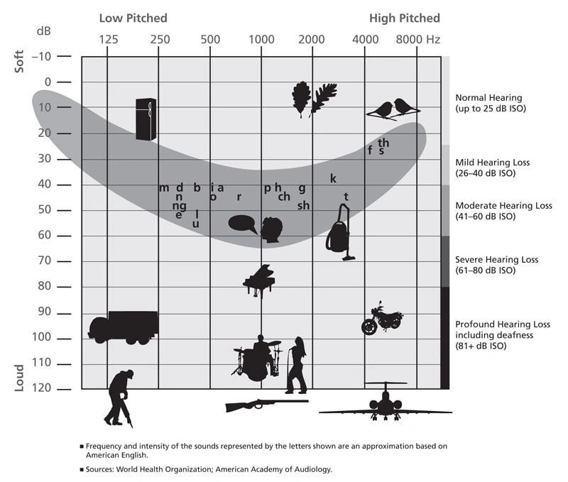 Diagram of the sounds and letters in speech that a person stops hearing at different levels of hearing loss.