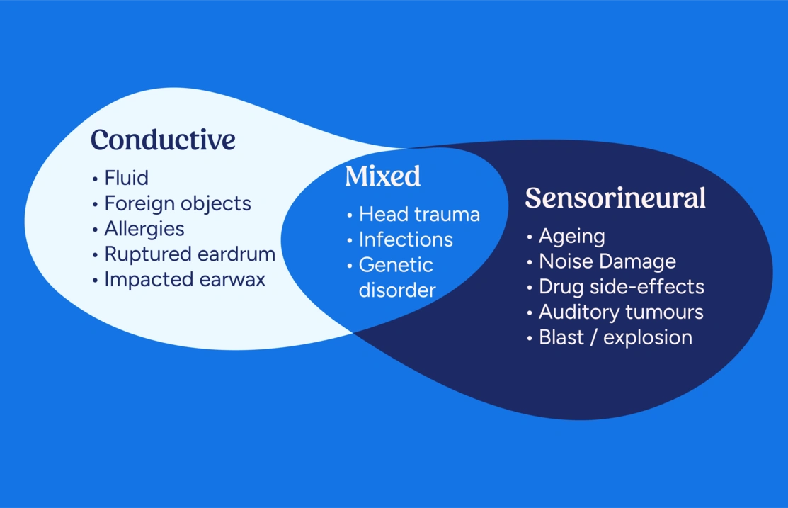 Venn diagram of different causes of hearing loss under three categories: conductive sensorineural and mixed.